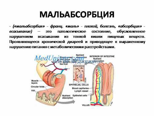 Отчетливое ухудшение состояния в ближайшие мин после приема молока после кормления грудного ребенка или после употребления молочных продуктов, особенно цельного молока, детьми старшего возраста с урчанием в животе, вздутием живота, беспокойством, болями в животе, появлением разжиженного стула возможно появление одного симптома или их комбинации характерно для лактазной недостаточности