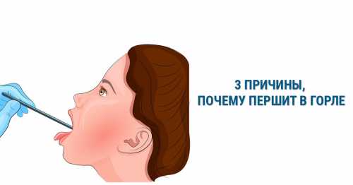 Условно различаются две группы факторов, связанных с профессиональной деятельностью и вызывающих дискомфорт в глотке