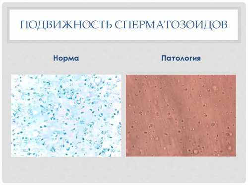 При диете полезно употребление следующих продуктов яйца, рыба, морепродукты, чеснок, греча, цельные злаки, фисташки, белые грибы, оливковое масло, морская капуста богаты селеноммясо нежирное, печень, зерновые культуры, отруби, устрицы, арахис, тыквенные семечки цинкмолочные продукты, сыры карнитин