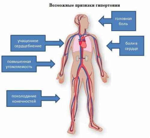 Признаки гипертонии