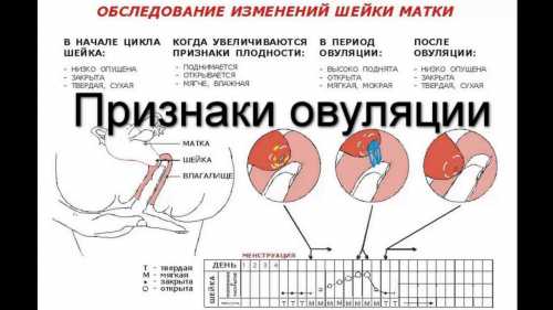 Боли или спазмы внизу живота