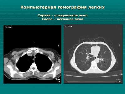 Таким больным часто рекомендуют сделать